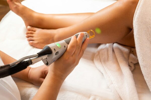 laser hair removal